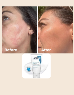 CeraVe Moisturizing Lotion